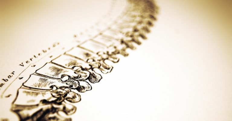 カイロプラクティック